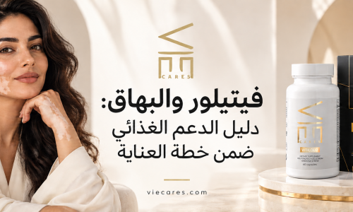 فيتيلور والبهاق: دليل الدعم الغذائي ضمن خطة العناية